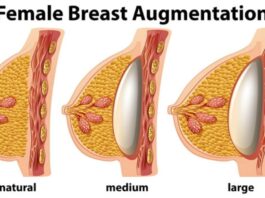 Understanding the Different Types of Breast Augmentation